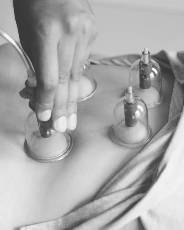 Gtaspine cupping 2